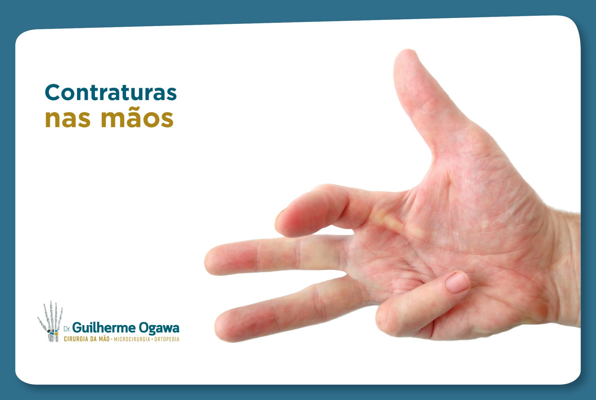 Contraturas nas mãos: entenda mais sobre o assunto - Guilherme Ogawa