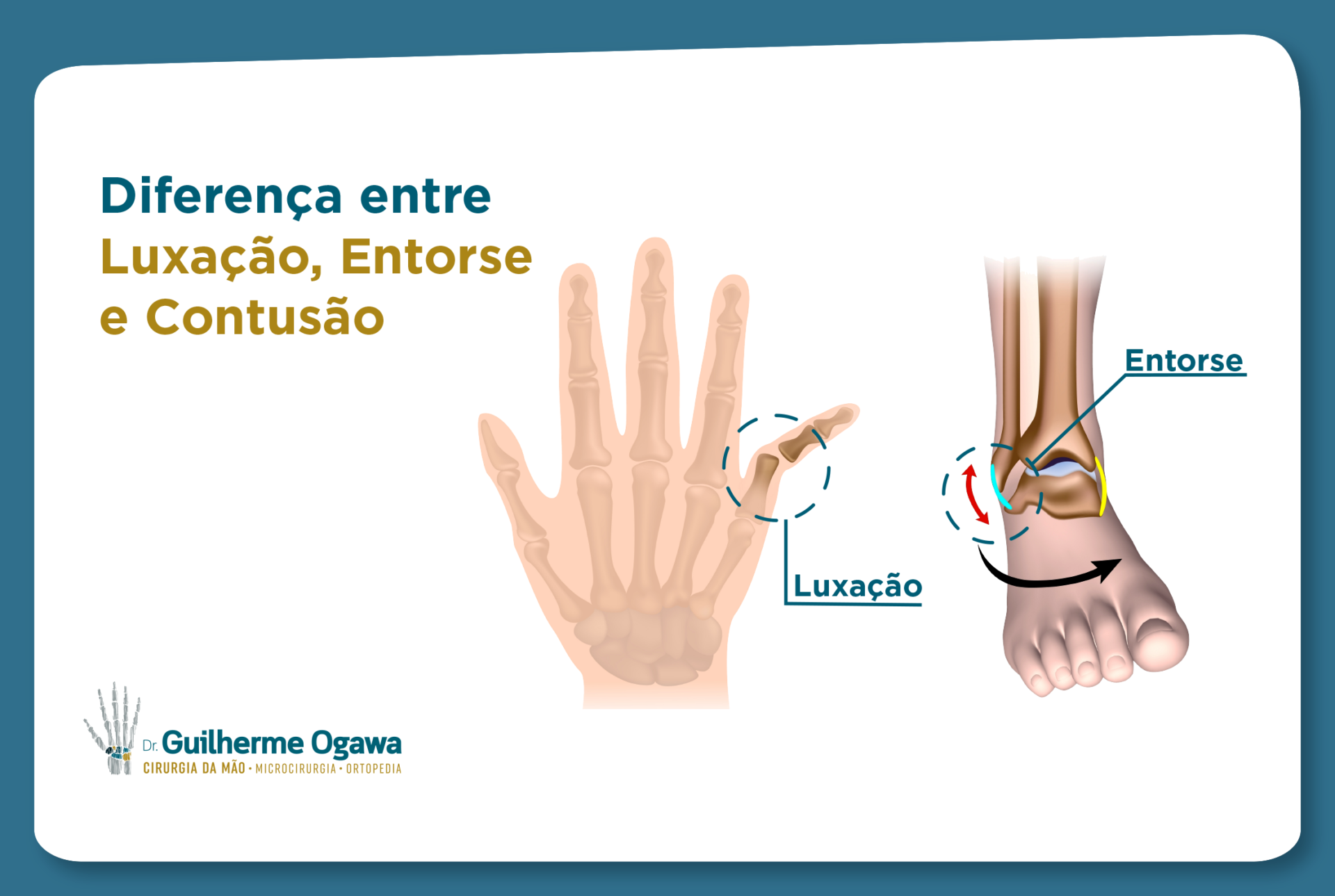 Diferença entre contusão, luxação e entorse – Guilherme Ogawa