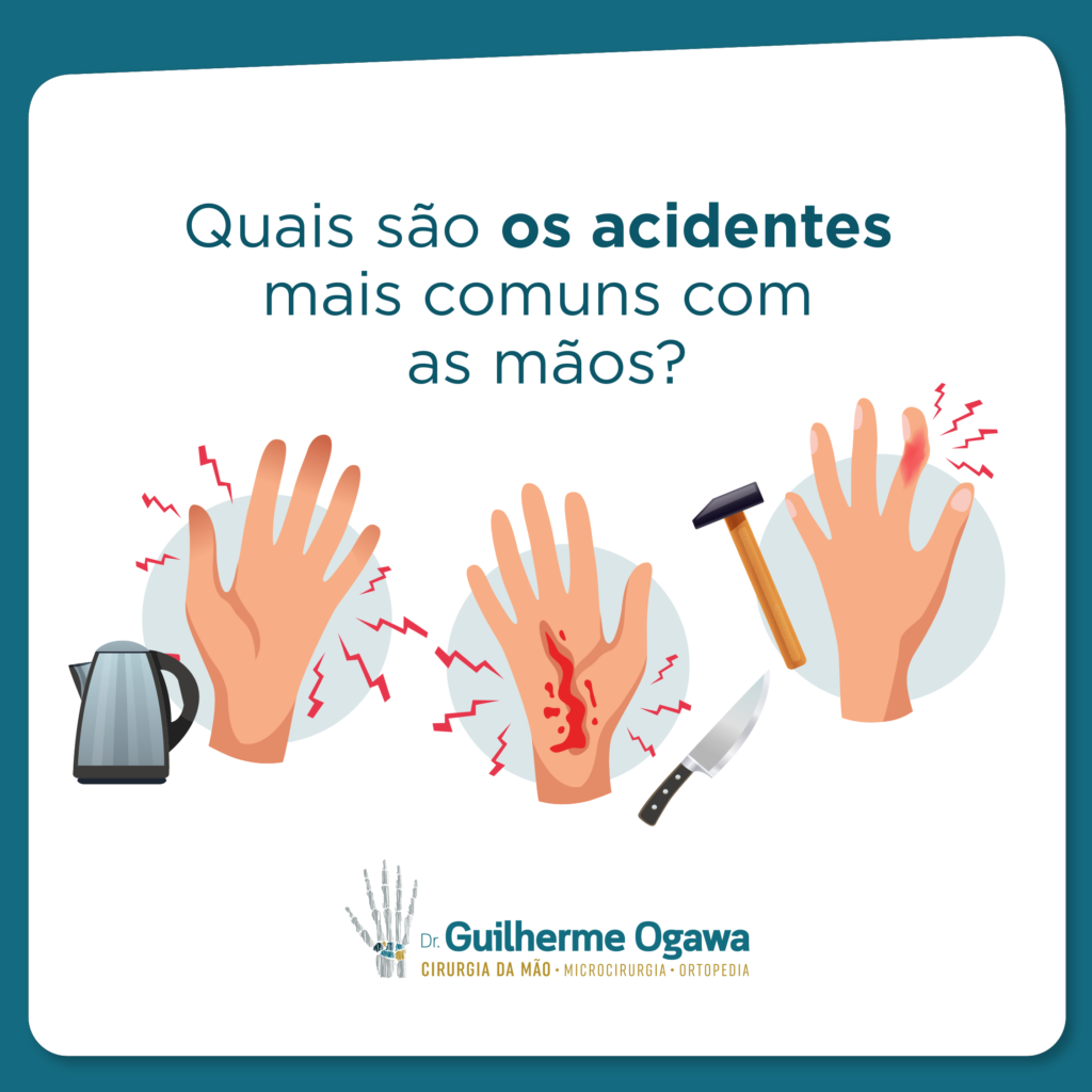 Quais S o Os Acidentes Mais Comuns Com As M os Guilherme Ogawa