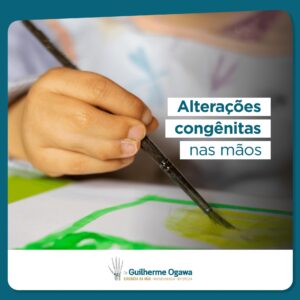 alterações congênitas nas mãos